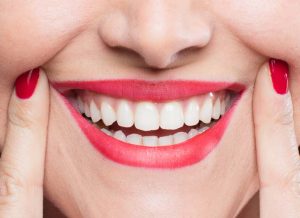 The Key to a Healthy and Confident Smile